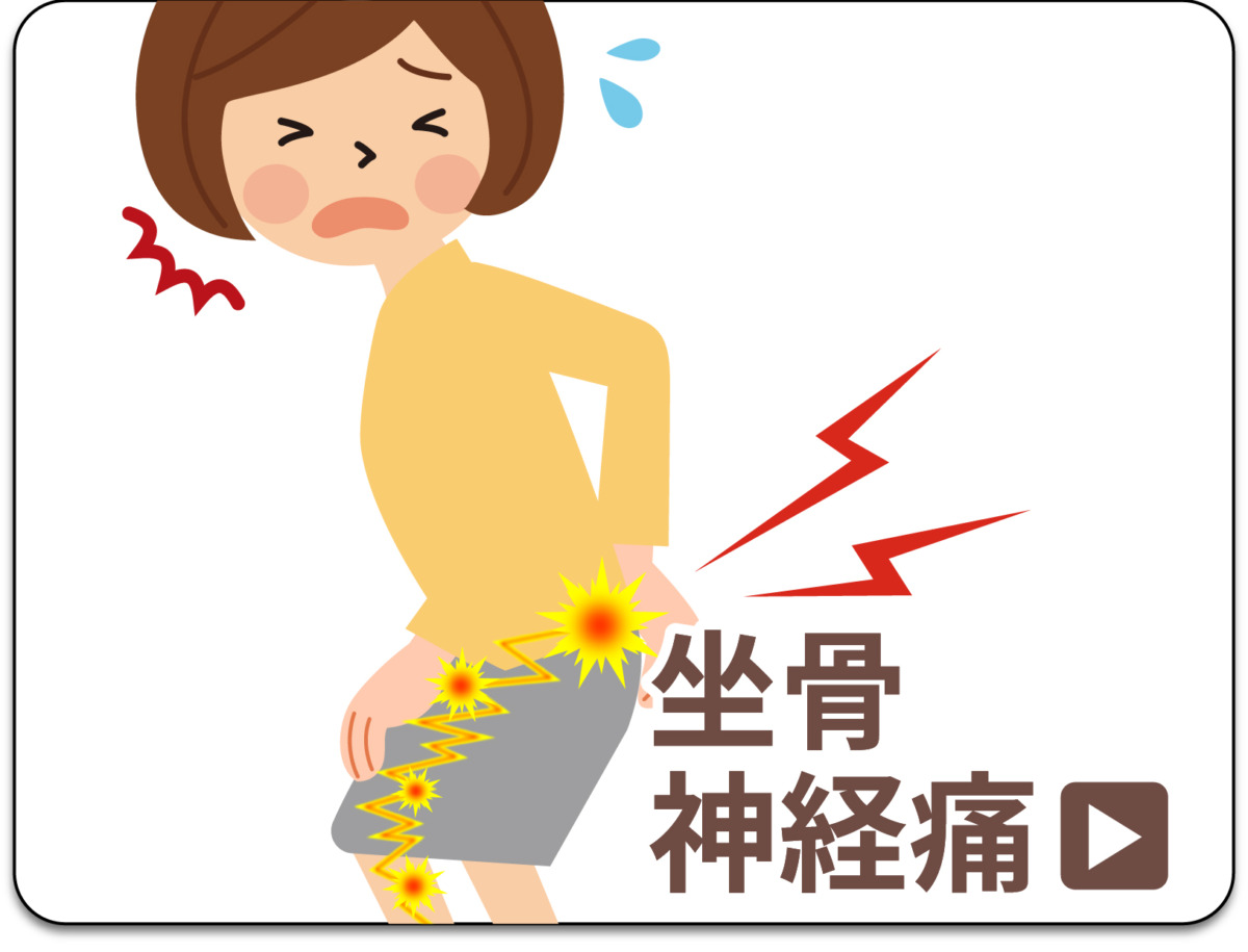 坐骨神経痛