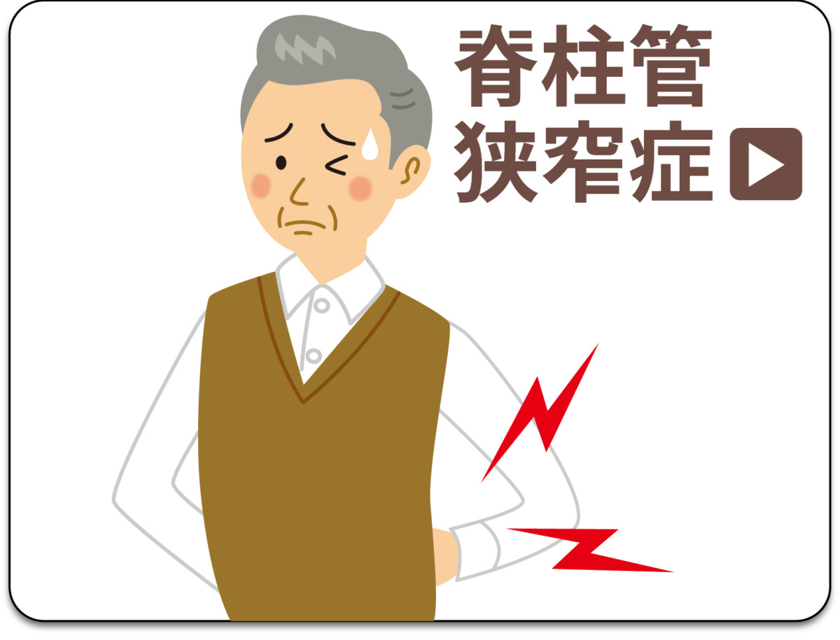 脊柱菅狭窄症