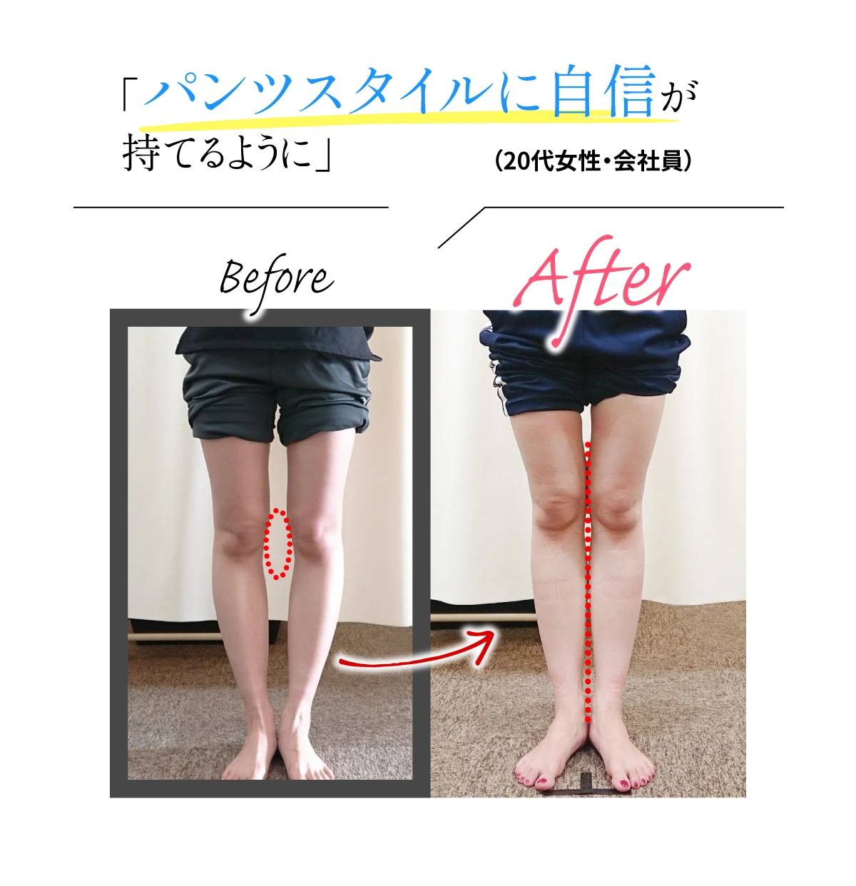 ビフォーアフター「パンツスタイルに自身が持てるように」